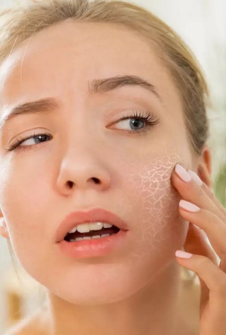 Dry skin